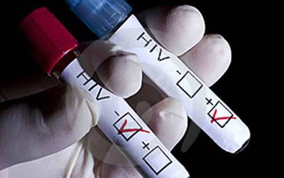 Triệu chứng HIV và các giai đoạn diễn biến của HIV ai cũng cần biết