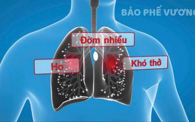 Ho, đờm kéo dài do viêm phế quản phải làm sao?