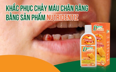 Khắc phục chảy máu chân răng bằng sản phẩm Nutridentiz