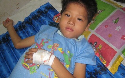 Xót xa cháu bé nghèo bị u phúc mạc sườn