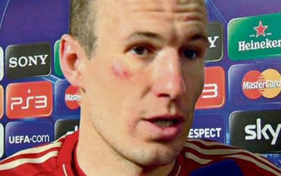 Đấm Robben bầm mặt, Ribery bị phạt khoản tiền lớn