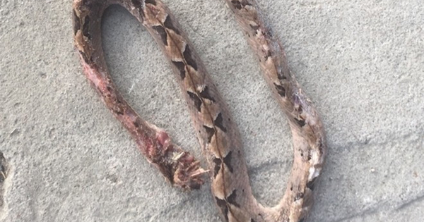 Người đàn ông 27 tuổi suýt mất mạng vì tự ý chữa bệnh theo “kiểu lạ đời