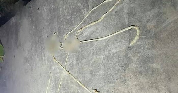 Bị rối loạn tiêu hóa, người đàn ông phát hiện 