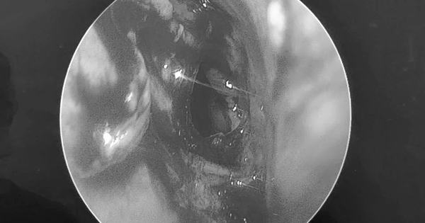 Đi khám, người đàn ông sốc nặng khi bác sĩ thấy thứ 