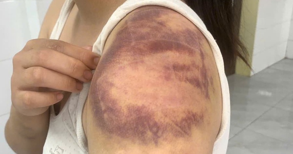 Bắt đối tượng ngược đãi, hành hạ vợ và con gái