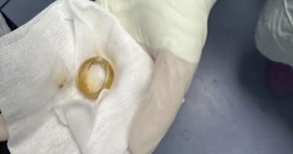 Khám cho cụ ông, bác sĩ phát hiện ra 