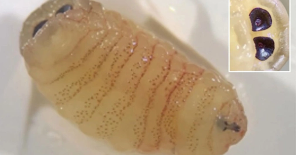 Người phụ nữ 58 tuổi “sốc nặng” khi hắt hơi ra hàng loạt con giòi sống từ trong mũi