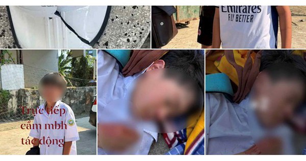 Nam sinh lớp 6 bị đánh hội đồng chỉ vì không cho mượn xe đạp