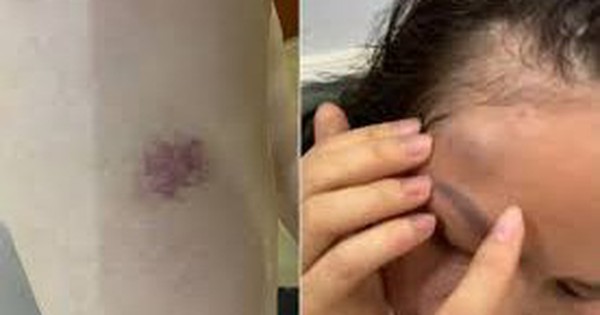 Hà Nội: Công an vào cuộc vụ một gia đình tố bị hàng xóm liên tục đe dọa, hành hung