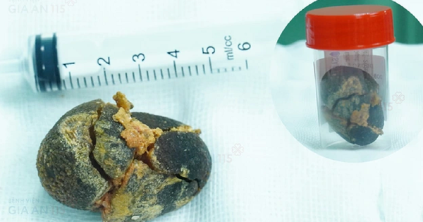 Đi khám sức khỏe định kỳ, người phụ nữ 