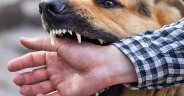 Sự cố thương tâm: Cụ ông 83 tuổi tử vong do chó nuôi trong nhà tấn công