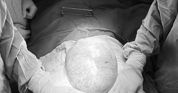 Bé gái 13 tuổi bụng to bất thường, bố mẹ sốc khi phát hiện bí mật 