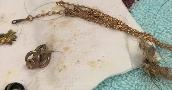 Mổ bụng cứu chó hoang, bác sĩ “đứng hình” khi phát hiện dây chuyền vàng đắt đỏ