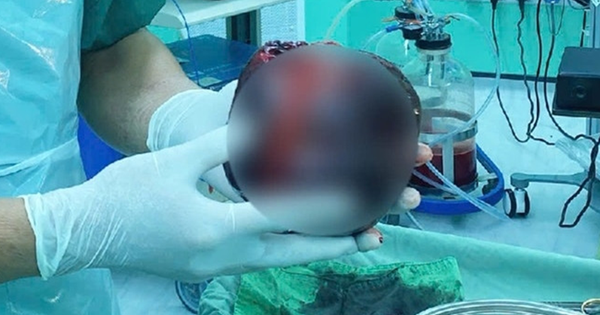 Đau bụng tưởng nhẹ, người đàn ông 