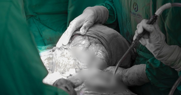 Người phụ nữ ở Hà Nội suy kiệt vì mang khối u khổng lồ 5kg
