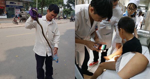Kacch Che Ran Chuyên gia chỉ rõ cách hạn chế bị rắn cắn tại khu đô thị