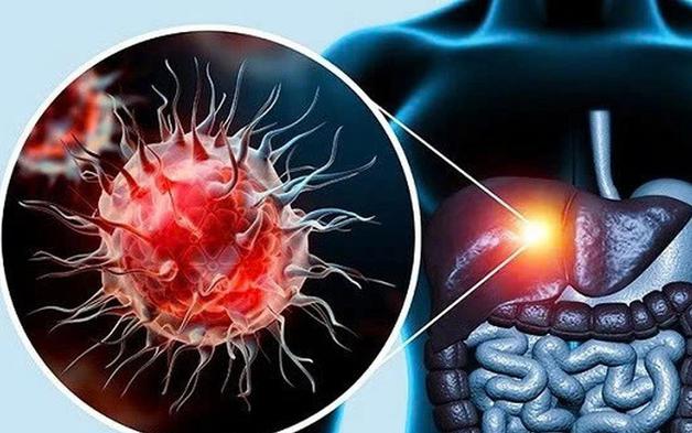 Không rượu bia, gan vẫn có thể tổn thương nặng vì lý do ít ai ngờ